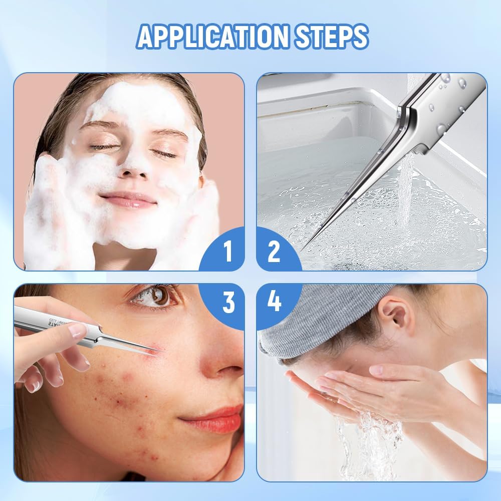 Professional Blackhead Remover Set - 7 Piece Stainless Steel Extraction Tools for Clear Skin