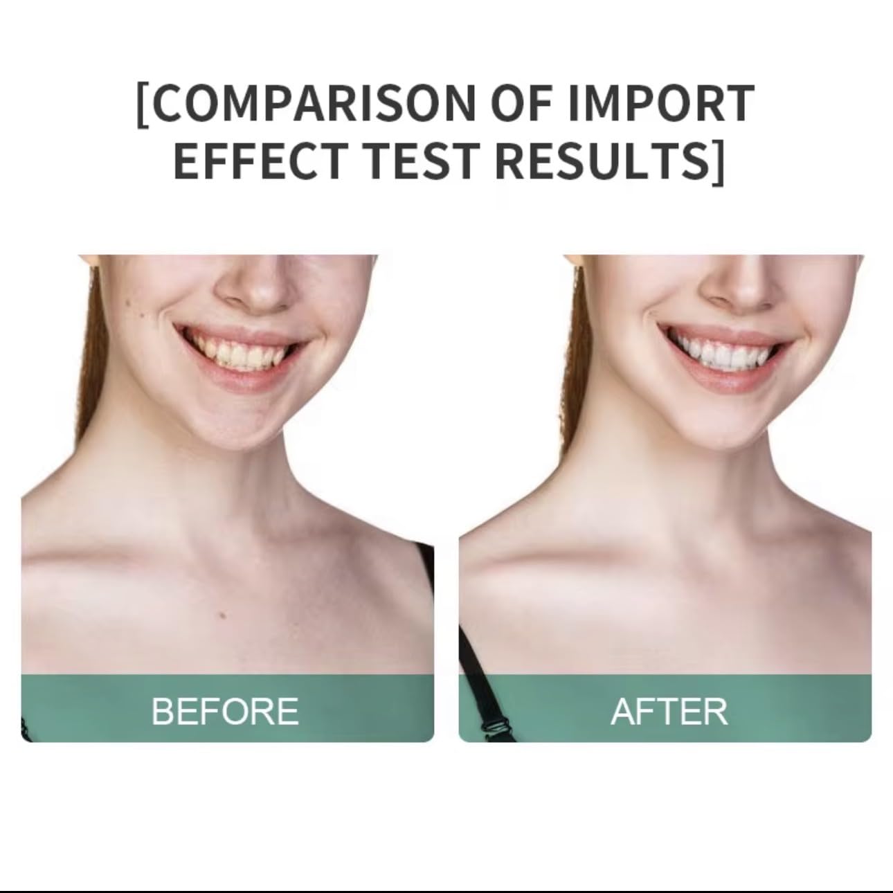 7-in-1 Facial Neck Massager with EMS Microcurrent, LED Color Light Therapy, Hot Compress, Skin Tightening, White