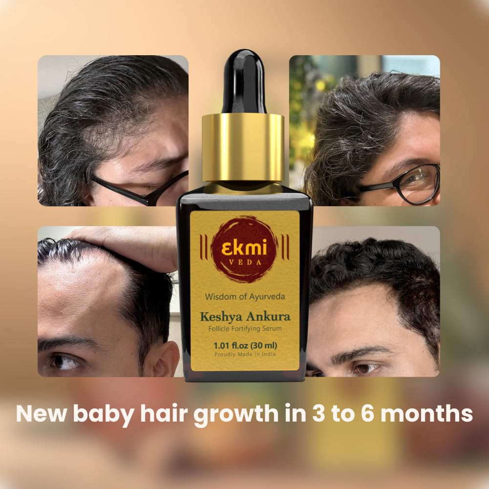 Ekmiveda Hair Growth Dht Blocker Serum With Redensyl, Procapil, Ayurvedic Herbs, Amla, Brahmi, Capilia Longa. Follicle Stimulating Hair Density Serum. Hair Loss Treatment For Women & Men, 1.01 Fl Oz