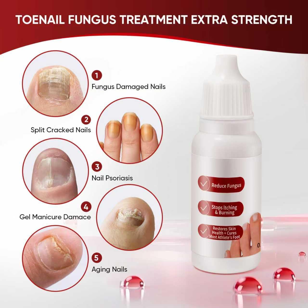 Toenail Treatment - Gentle Formula for Healthy, Beautiful Nails | 1 Piece
