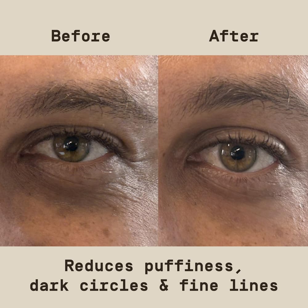 Fast-Acting Under Eye Patches for Men - Reduce Puffiness & Dark Circles | Niacinamide, Hyaluronic Acid, Caffeine | 6ct