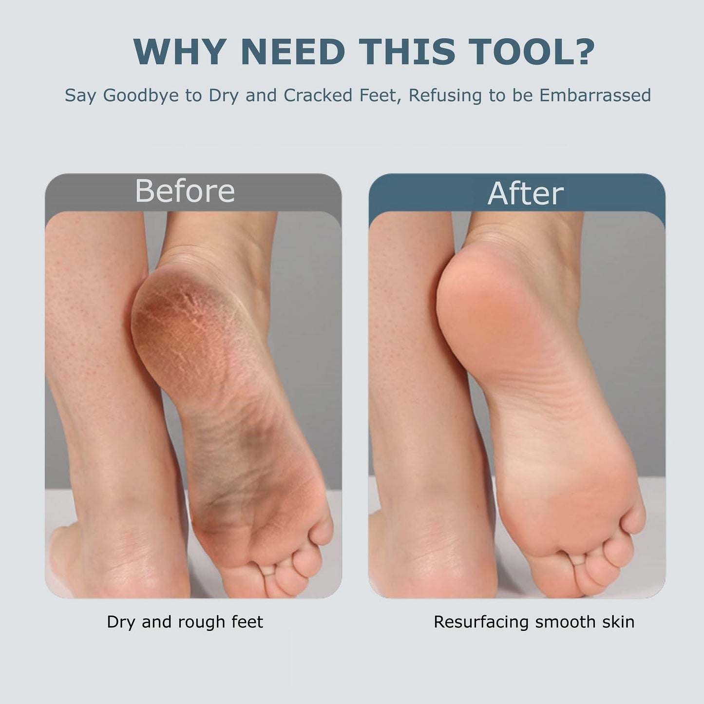 Upgraded Electric Foot Callues Remover, Portable Electric Foot Files with 3 Heads, Rechargeable Feet File for Foot Care, Waterproof Deadskin Remover, Pedicure Tool for Dry and Crack Feet