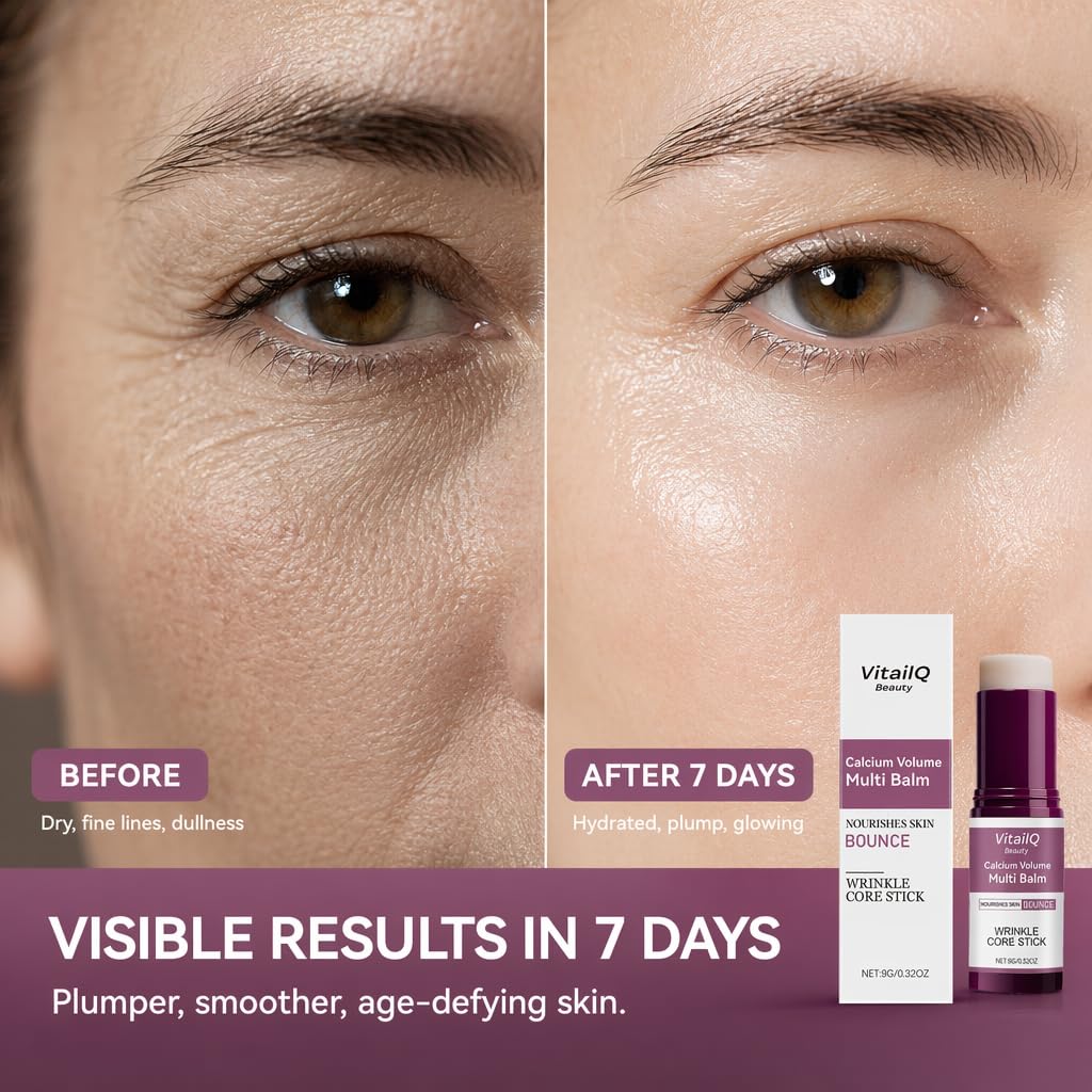VitailQ Anti-Wrinkle Calcium Balm - Hydrating Face Moisturizer for Eyes, Neck & Face