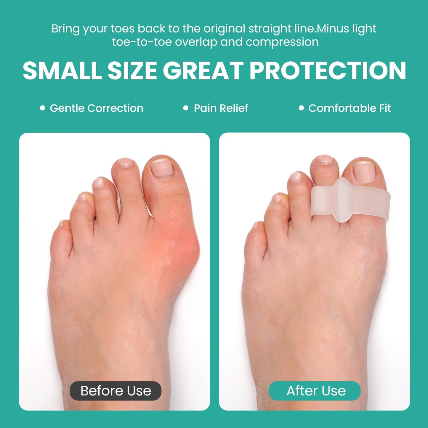 Bunion Corrector - Pack of 12 Toe Separators with 2 Loops | Big Toe Spacer with Aloe Vera Extract - Clear