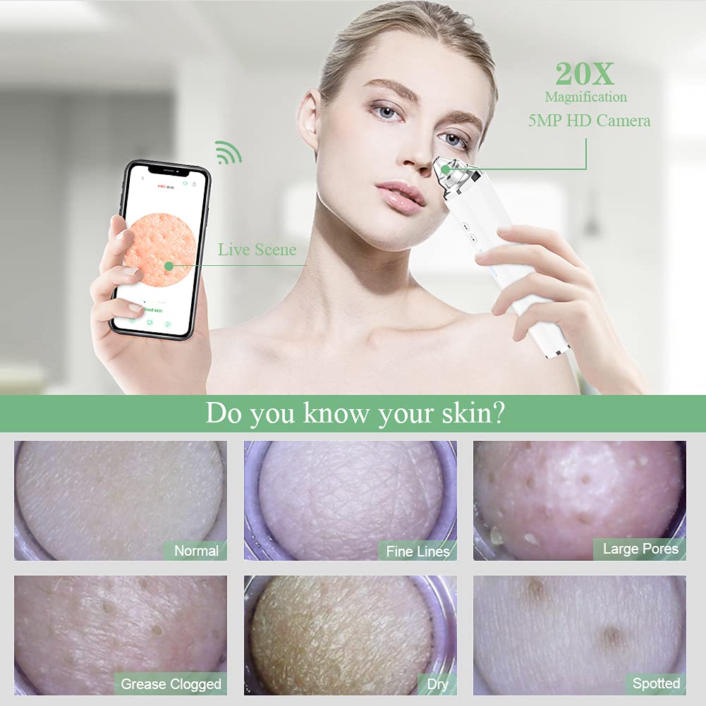 Blackhead Remover Pore Vacuum with 5MP HD Camera, 20X Magnification WiFi Visible Facial Pore Cleanser, FDA-Registered Electric Pimple Acne Comedone Extractor Kit for Men & Women with 6 Probes