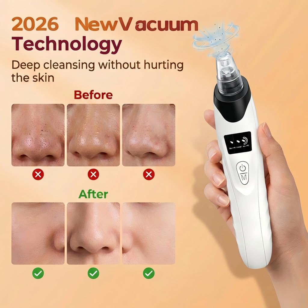 Blackhead Remover Vacuum - 9-in-1 Pore Cleaner Kit with 5 Probes & 4 Extractor Tools | Professional Facial Suction Tool (Black)