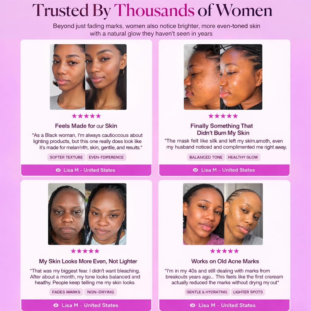 Brightening Cream - Arbutin & Tranexamic Acid for Uneven Skin Tone | Daily Skincare Routine (1.7 oz)