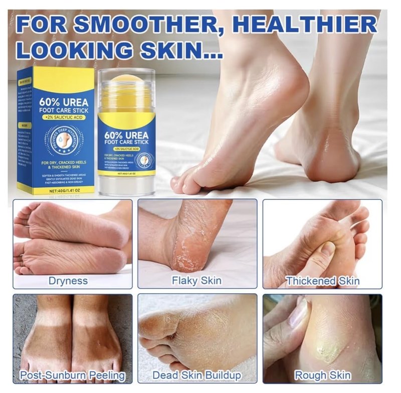 Urea Cream Stick - 60% Urea & 2% Salicylic Acid | Maximum Strength Foot Care Balm for Dry Cracked Skin