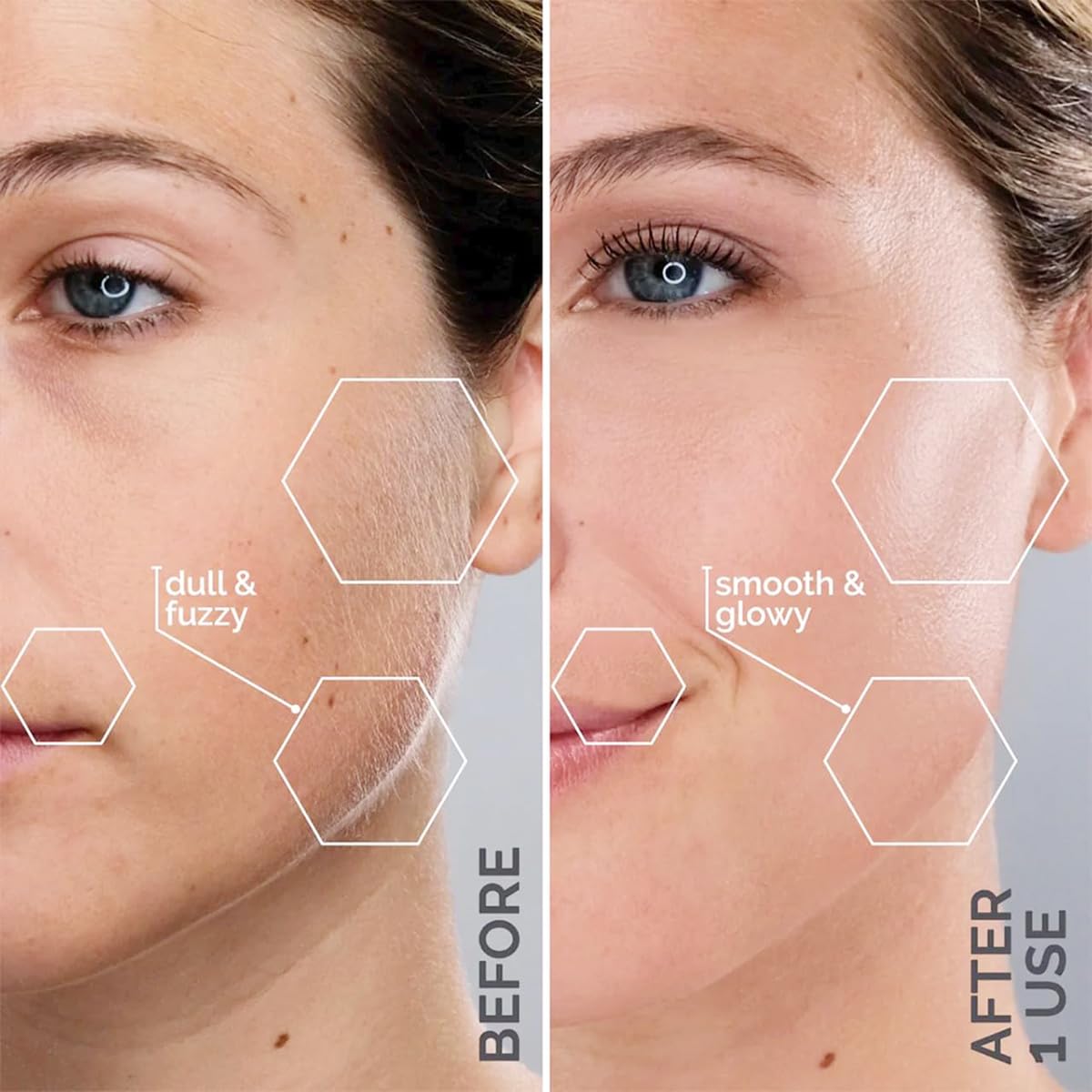 Michael Todd Beauty Sonicsmooth Dermaplane Razor - Women's Face & Eyebrow Trimmer | 8 Weeks of Blades for Smooth Skin