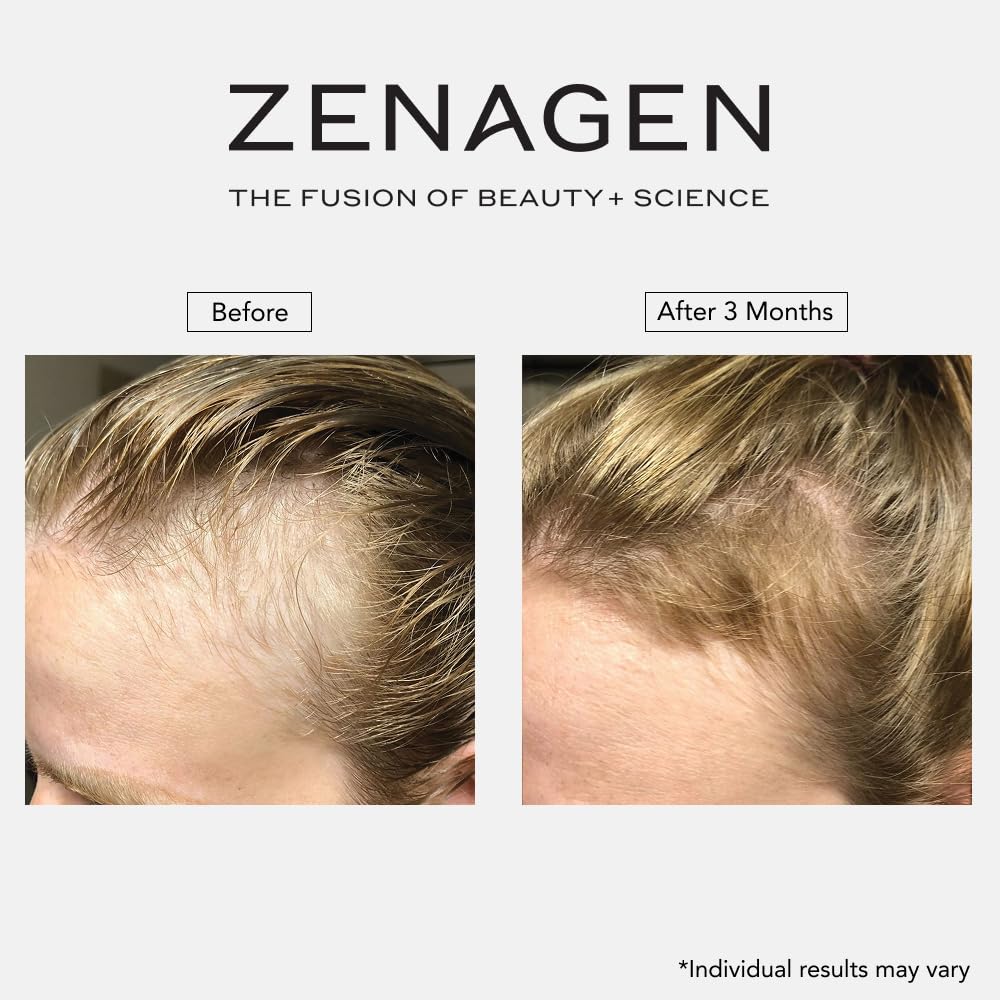 ZENAGEN Revolve Thickening Shampoo for Fine & Thinning Hair - Plant-Based, Color-Safe 5-Minute Treatment