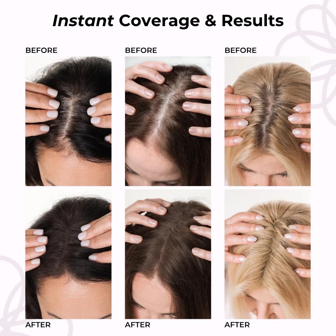 HairMagic+ Root Touch Up Powder - Instant Gray Coverage & Hairline Filler | Water-Resistant, Natural Finish with Argan Oil & Vitamin E (Dark Brown)