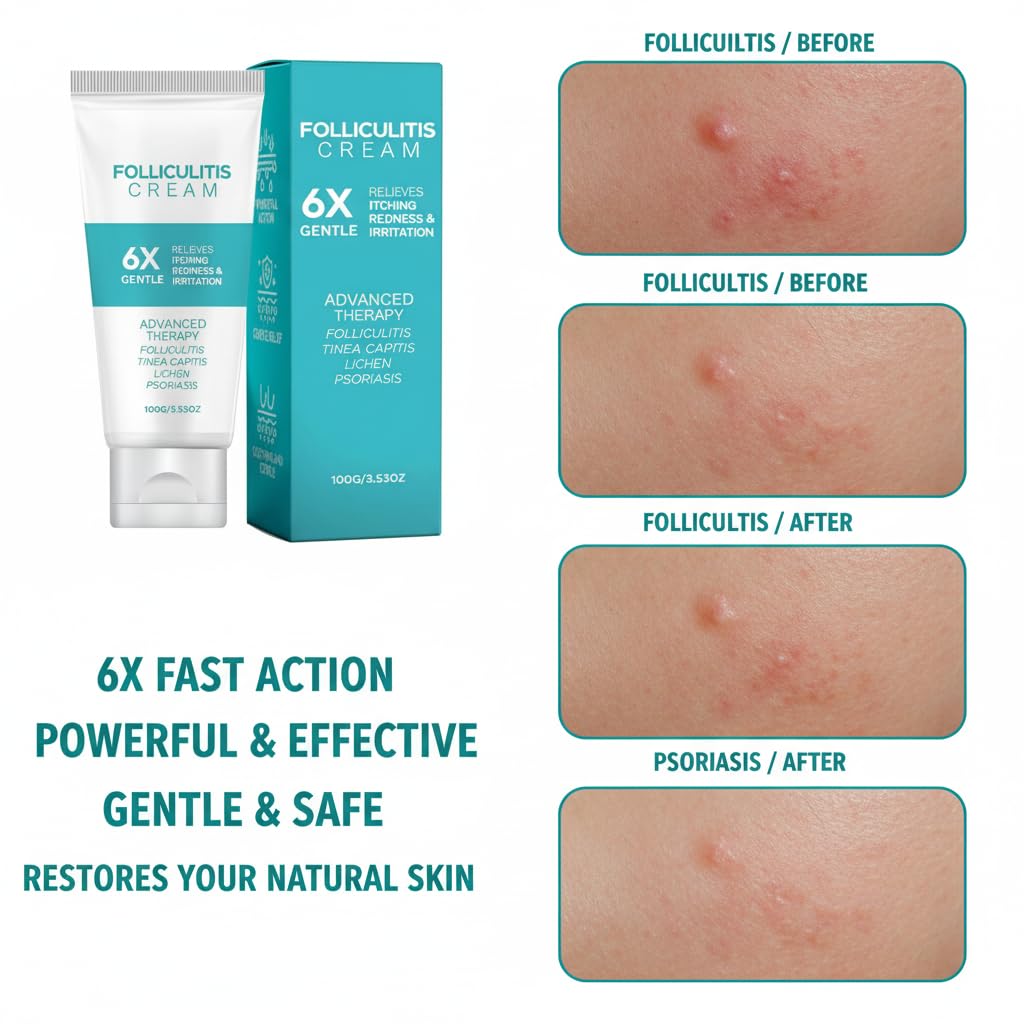 Folliculitis Cream 3.53oz (100g) – Cooling Herbal Skin Cream for Scalp, Face & Body – Helps Soothe Irritated Skin, Redness & Bumps – Fast Absorbing Daily Care, 1 Pack