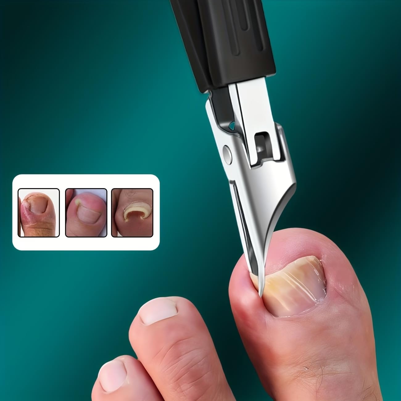 Thick Nail Clipper for Ingrown Nails Stainless Steel 25-Degree Angled Blade Safety Grip Handle Splash-Proof for Seniors, Black