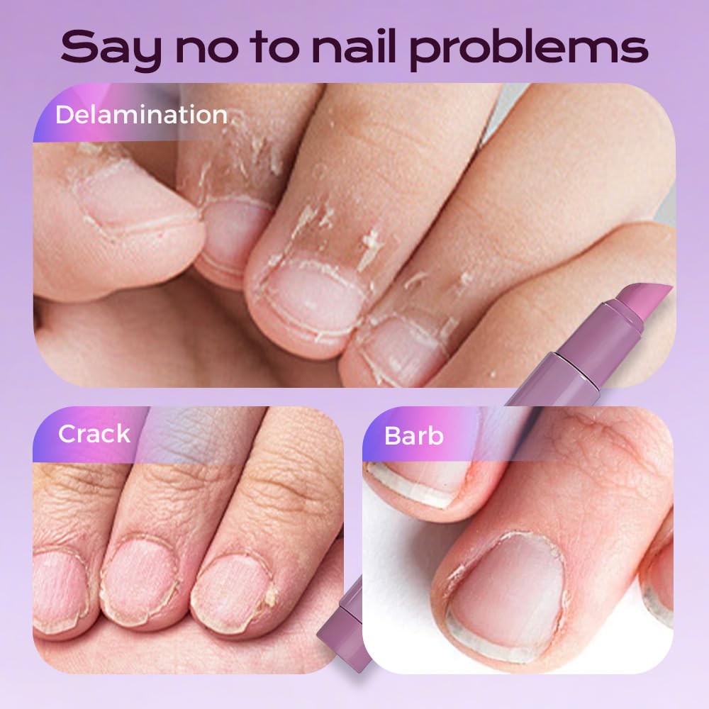 Cuticle Treatment Pen - 3-in-1 Nail Care Remover & Pusher with Ceramic Tip | Purple