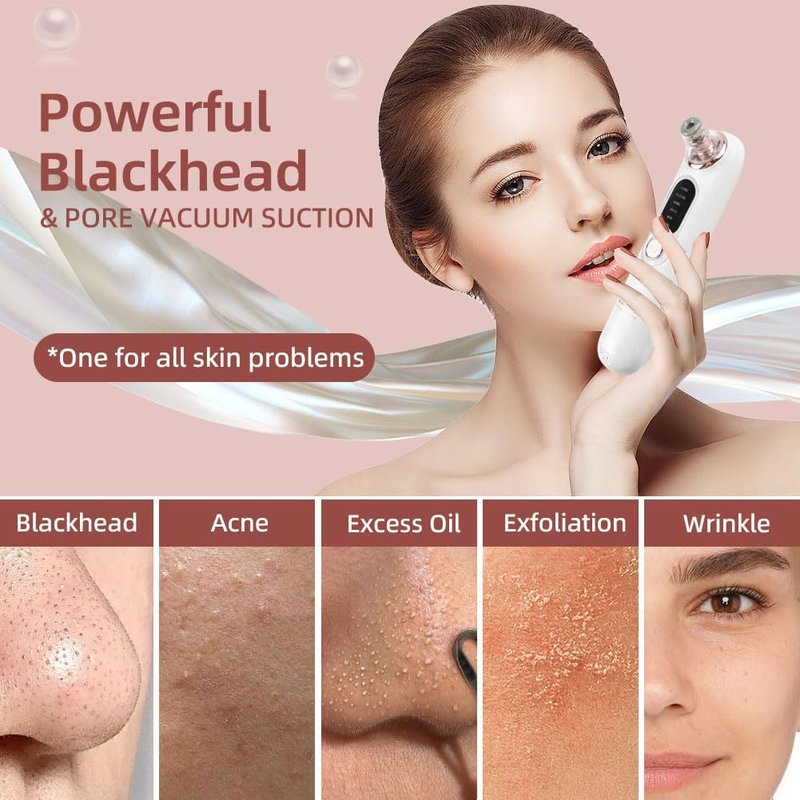 Blackhead Remover Vacuum - 5-Speed Type-C Rechargeable Extractor with 4 Heads | Effective Face & Nose Tool for All Skin Types
