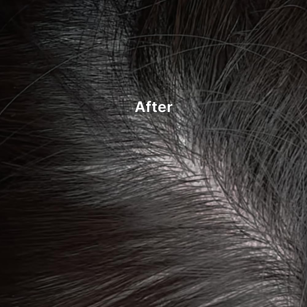 Kelp Scalp Serum - Hydrating Treatment for Dry, Itchy Scalp | Korean Hair Growth & Care | 2.7 fl oz / 80 ml