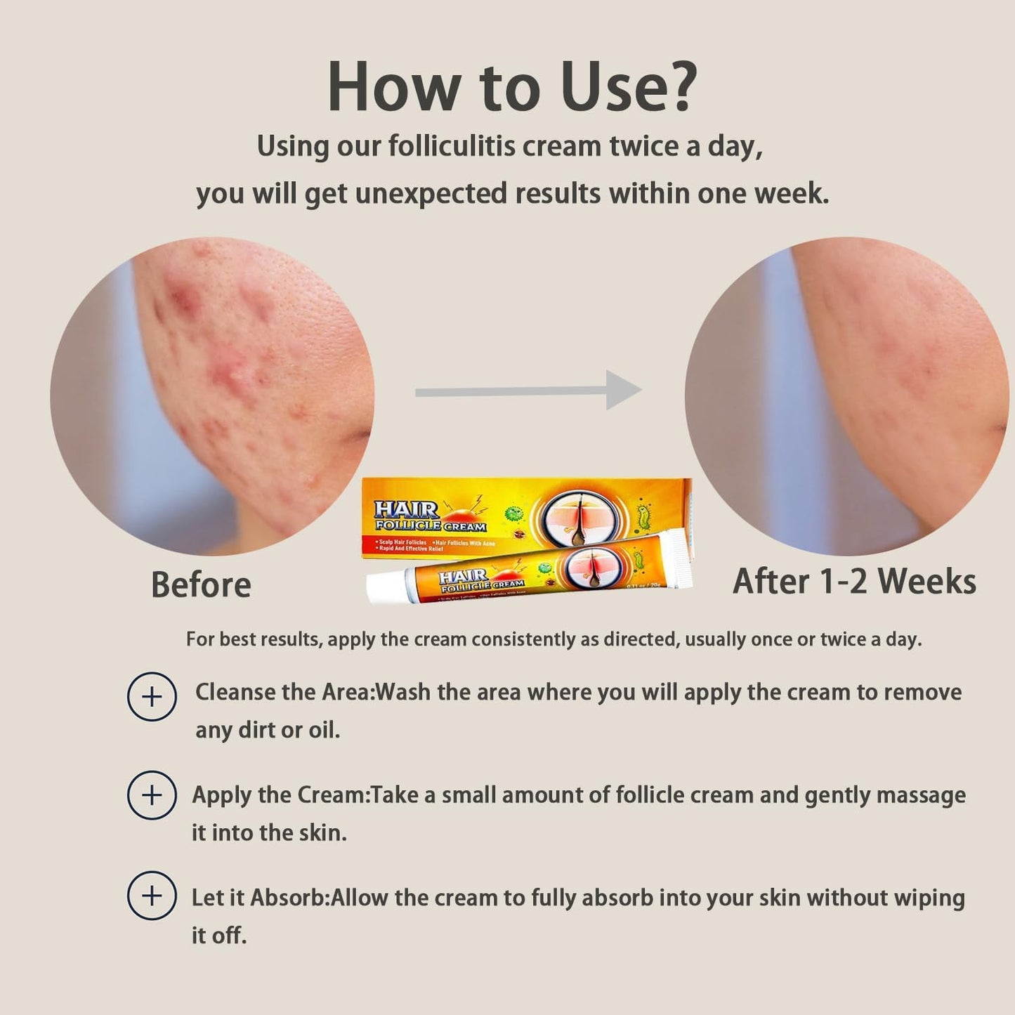 Folliculitis Treatment Cream - Effective Relief for Scalp, Face & Body | 1.42 Oz