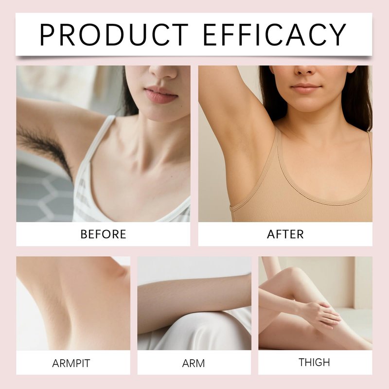 No-Shave Hair Removal Cream, Gentle Hair Dissolving Formula with Calcium Thioglycolate, Panthenol and Shea Butter, Sensitive Skin Friendly, 150g/5.29oz