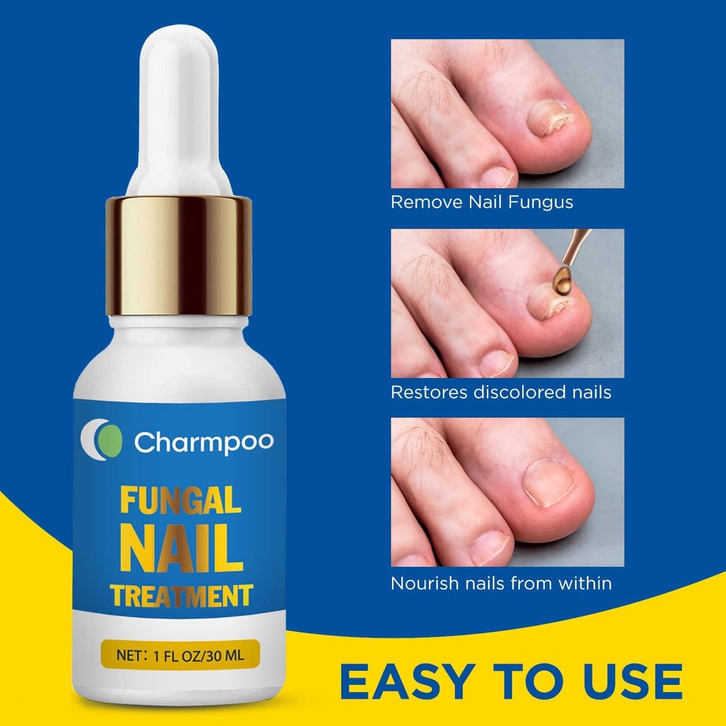 Toenail Fungus Treatment Extra Strength: 30ml(Pack of 2) Nail Cuticle Care Serum – Infused with Botanical Herbal Extracts for Clear Healthy-Looking Nails Lightweight Daily Nail & Toe Care