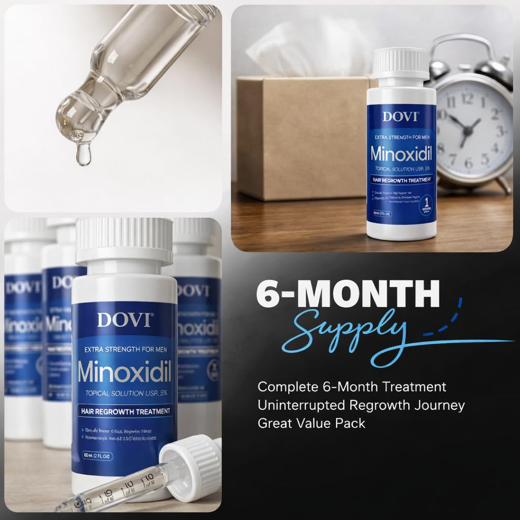Dovi Minoxidil 5% Hair Regrowth Treatment for Men – Extra Strength Advanced Topical Solution, 6 Month Supply, Helps Regrow Hair and Prevent Hair Loss