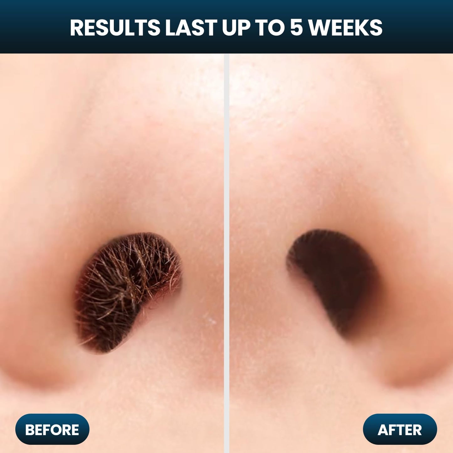 AUZEAL Nose Wax Kit, Nose Hair Wax Kit with 100 g Wax, 20 Applicators, Nose Ear Hair Removal Kit for Men Women, Easy, Quick & Painless, Lasts up to 5 Weeks