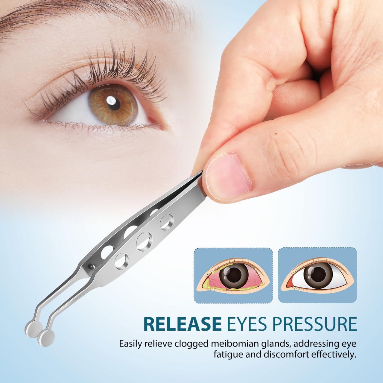 Didiseaon Meibomian Gland Massage Forceps Round Tip Eyelid Tweezers for Clogged Eyelid Gland Relief Eye Stye Remover Tool Precision Design for Eye Bag and Swelling Care