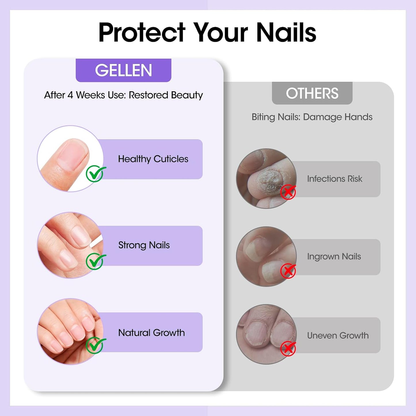 Gellen Nail Biting Treatment - 15ml Bitter Taste Solution for Kids & Adults | Stop Nail Biting & Thumb Sucking