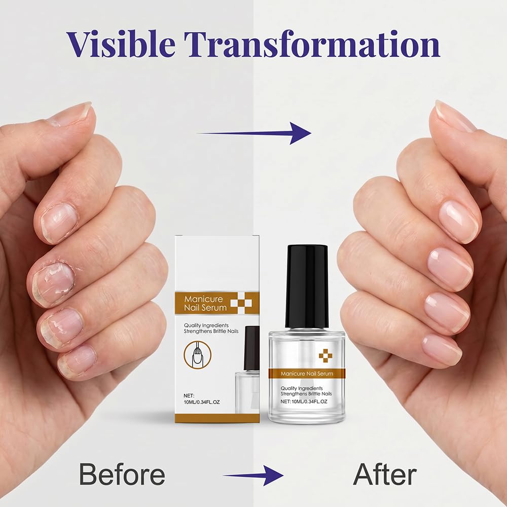 Nail Care Oil with Keratin, 2026 New Keratin Nail Strengthener, 3-Day Intensive Care for Dry & Brittle Nails, Fast Hydration & Repair Treatment (1pcs)