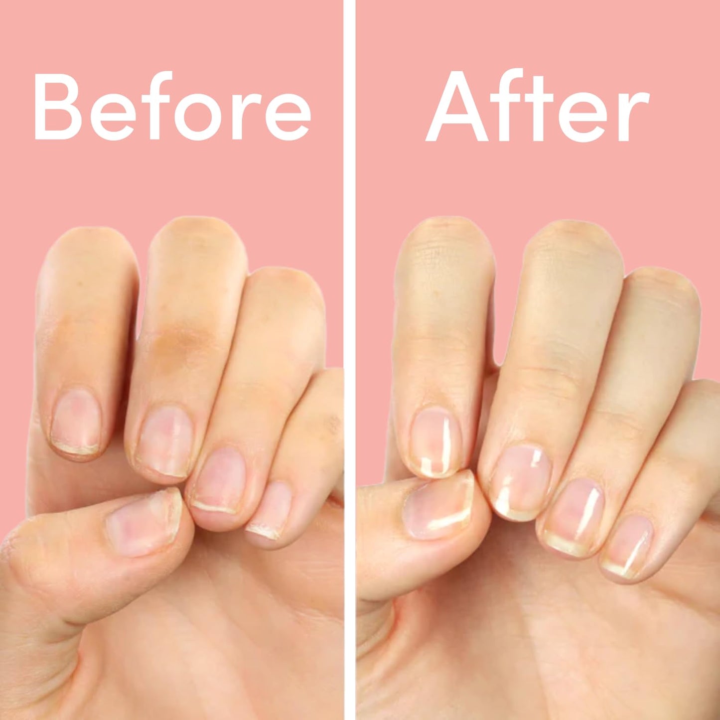 Nail Strengthener & Growth Treatment - Ella+mila First Aid Kiss Hardener for Damaged Nails | Vegan, 0.45 fl oz