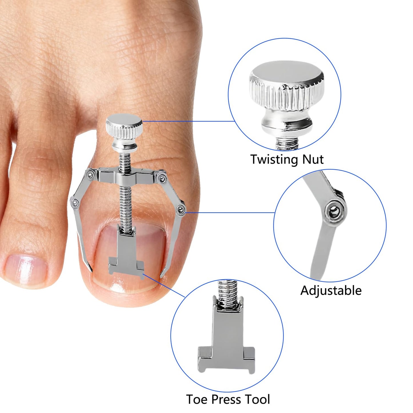 CHEMAILON Professional Ingrown Toenail Correction Kit - Stainless Steel Ingrown Toenail Clippers, Correction Patches, Lifter & Tools for Ingrown Toenail Treatment, Home Pedicure Solution