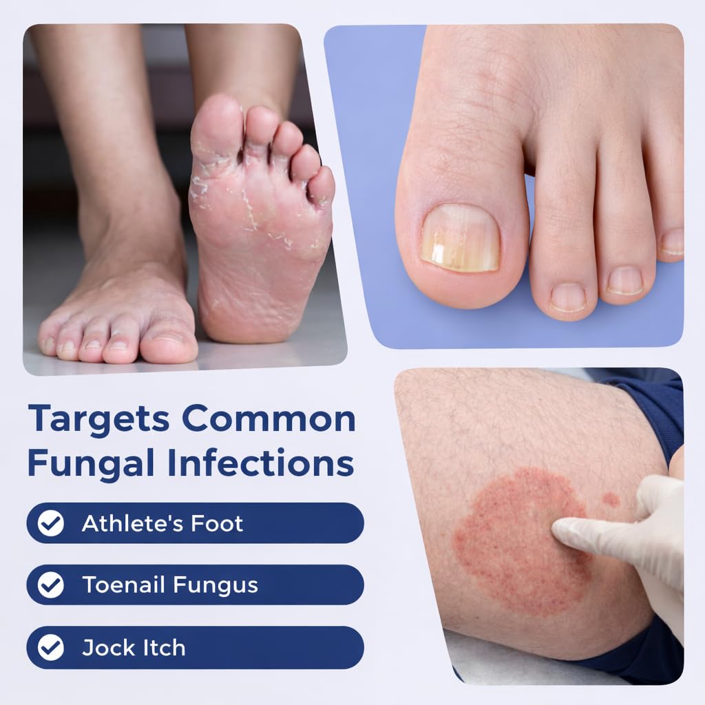 Toenail Fungus Treatment Pen - Extra Strength with 25% Undecylenic Acid | Nail Strengthener for Discolored & Ingrown Nails