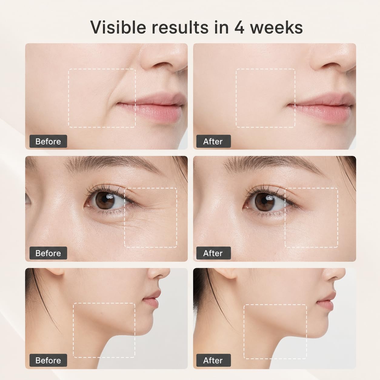 Surgia Pro 4-in-1 Korean Beauty Device - Facial Lifting, Pore & Collagen Care | Home Skincare Massager