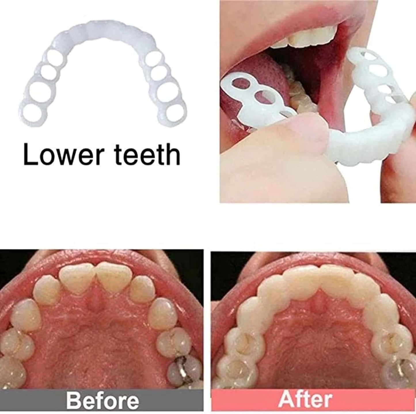 2 Pairs, Beautiful Smile,Top and Bottom, Temporarily Adjustable for Men and Women Teeth Whitening Kits(white01)