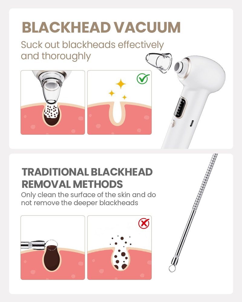 Blackhead Remover Pore Vacuum with Heating - Blackhead Extractor with 3 Adjustable Suction Levels, 5 Probes - Blackhead Remover Tools for Women & Men (White)