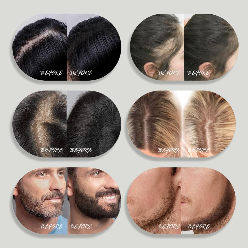 Minute Hairline Powder - Auburn Root Touch Up Hair Color for Gray Coverage | 10g Bald Spot Concealer for Men & Women