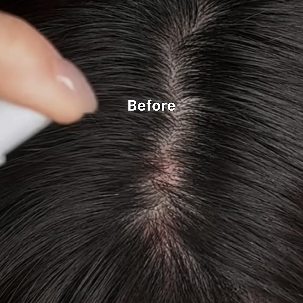 Kelp Scalp Serum - Hydrating Treatment for Dry, Itchy Scalp | Korean Hair Growth & Care | 2.7 fl oz / 80 ml