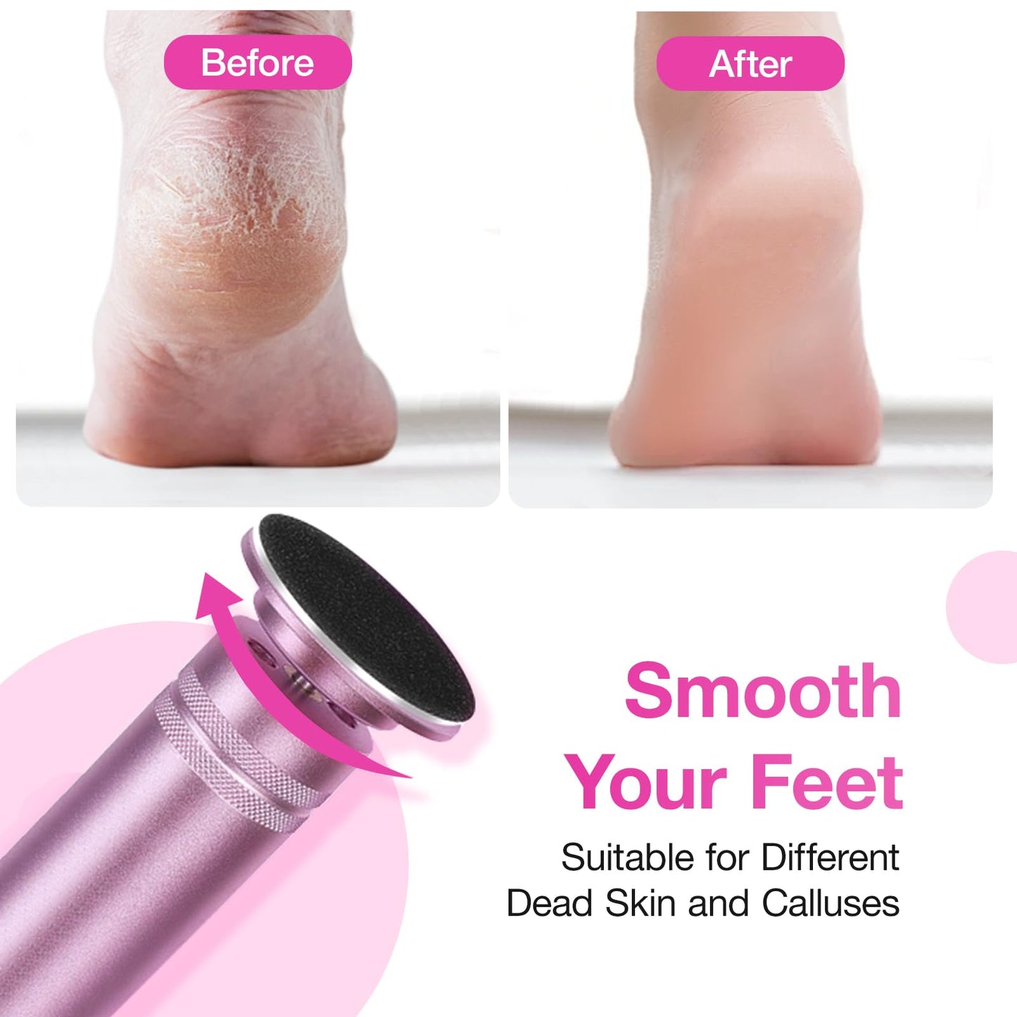 Hocent Upgrade 1200RPM Electric Callus Remover for Feet, Powerful Electric Foot File with 60 Sandpaper Discs, Adjustable Speed, Plug-in Pedicure Tool for Cracked Heels & Dead Skin, Pink