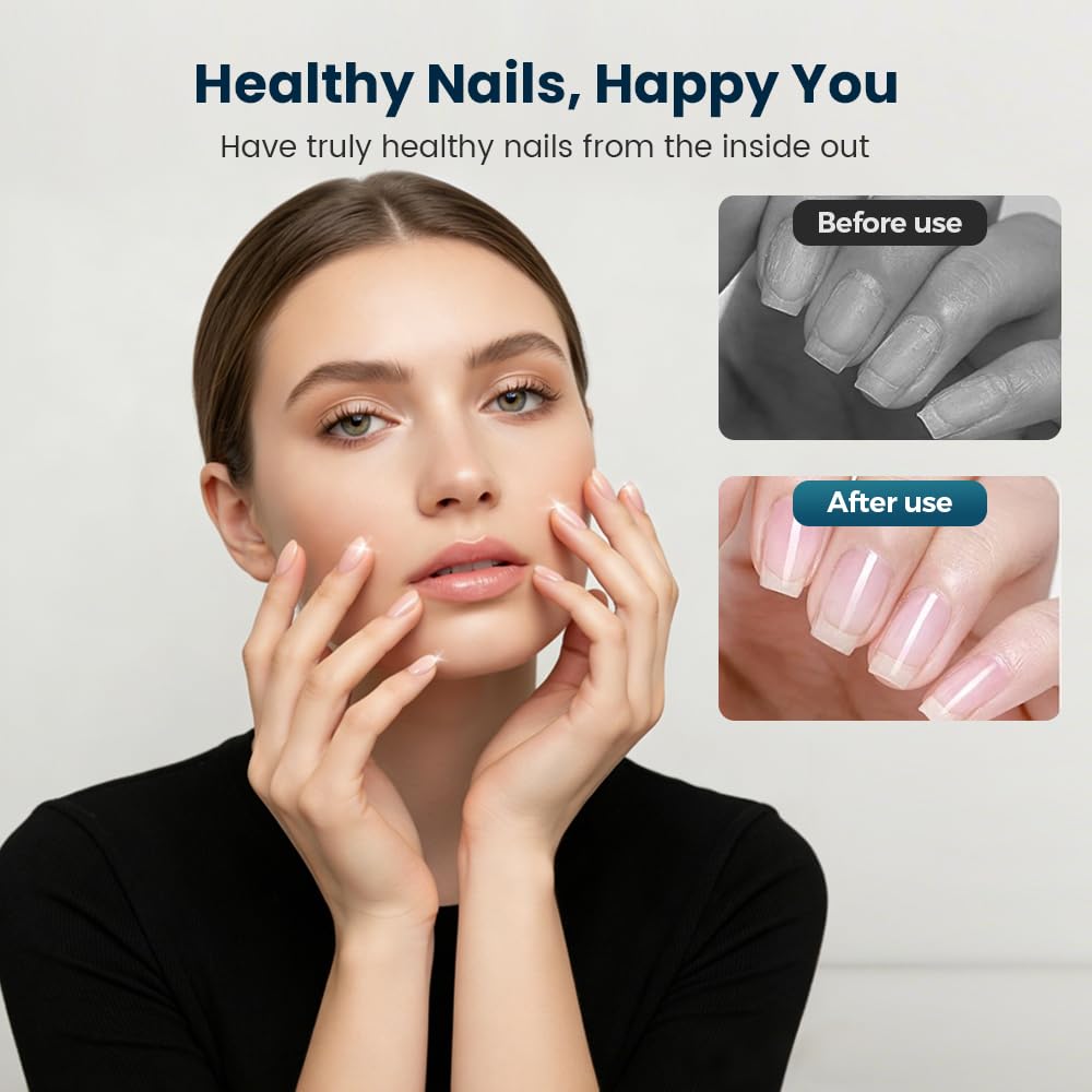 Nail Care Oil - Upgraded Keratin Nail Strengthener & Moisturizer for Brittle Nails | 1 Piece