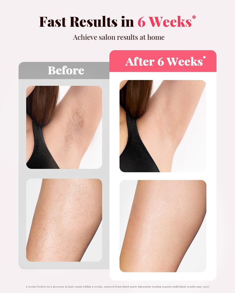 Hair Remover for Women and Men - 5.2 cm² Contact Nearly Painless, Powerful Long-Lasting Hair Remover at-home, Effective in 14 Days with Ultra-fast Light Emission for Whole Body Use