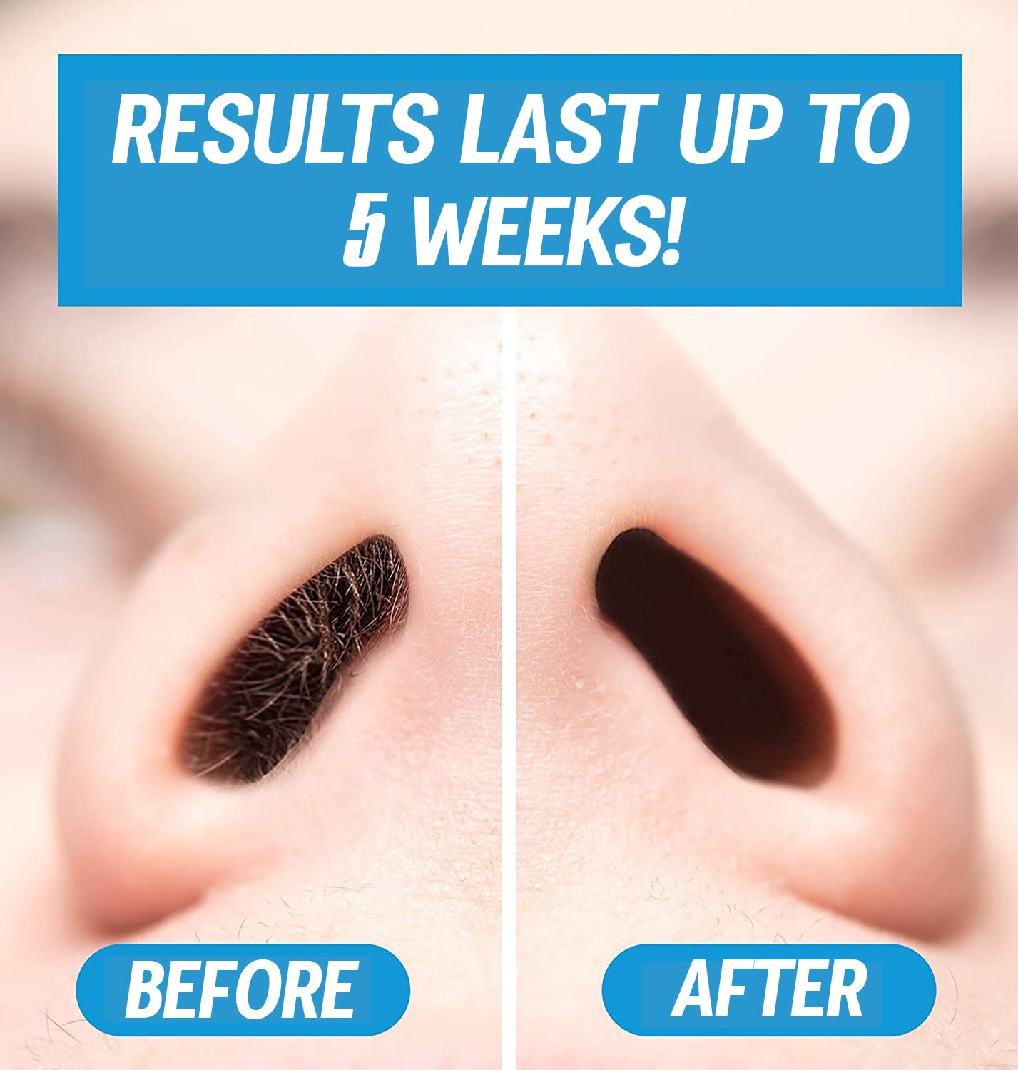 Nose Waxing Wax from Kenashii, 100g / 3.5 oz of Hypoallergenic Wax for Nasal Hair Removal, Specially Formulated to Never Get Brittle or Snap Off in Your Nose, Wipes and Applicators Sold Separately