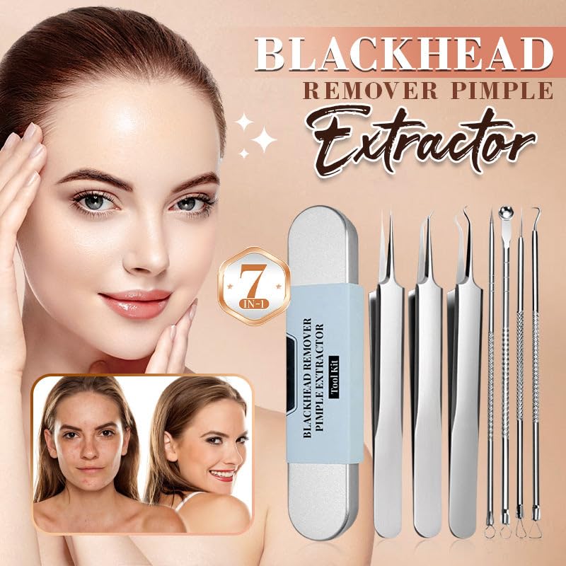 Aocesk 7-Piece Blackhead Removal Tool Kit - Acne Extractor Set