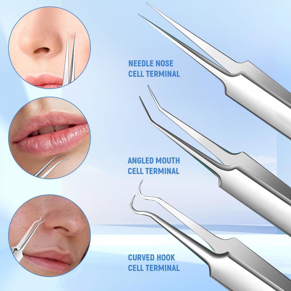 Jurfest 7 Piece Set Blackhead Extraction,Stainless Steel Blackhead Remover, Professional Facial Blackhead Remover Tweezers