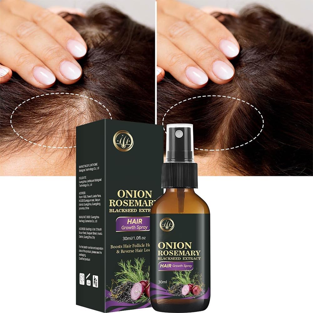 Onion Hair Growth Spray - Organic Rosemary Water for Hair Loss Control | 2PCS