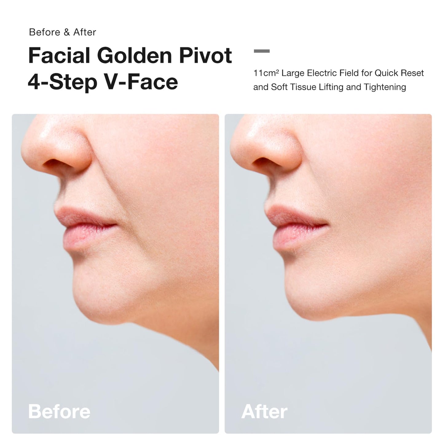 JOVS Slimax Full-Body Anti-Aging Device with Red Light Therapy, 4-Step V-Face Lifting, Scalp & Hair Strengthening, Body Contouring, Skin Care Beauty Device for Face and Hair at Home Use