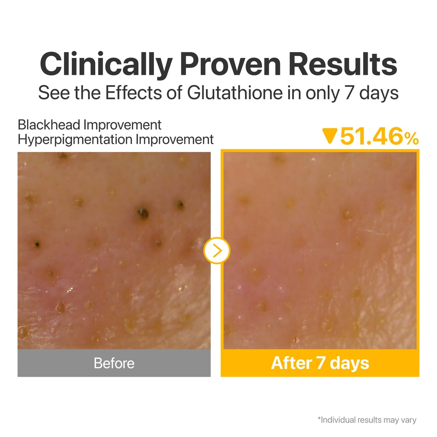 Numbuzin No.5 Cleansing Oil - Glutathione & Vitamin C for Pores, Sebum & Dark Spots | 6.76 fl oz