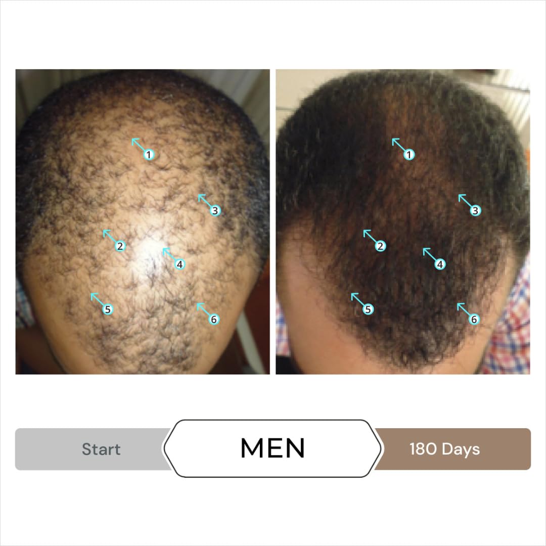 Spectral Hair Density Serum for Men - Strengthening & Thickening Leave-In Treatment | 60mL