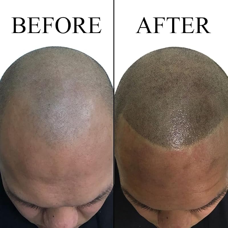 Nuva Scalp Micro-Pigmentation Ink - Dark Brown, Vegan, USA-Made
