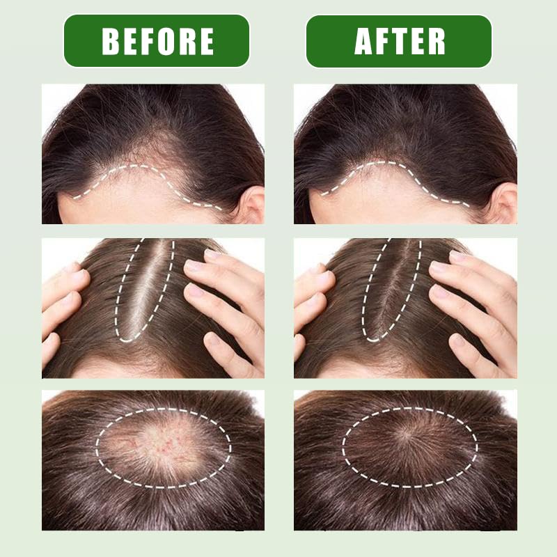 Raw Batana Oil for Hair Growth - Natural Hair Care with Pleasant Scent & Smooth Texture | Pumpkin Seed Oil Blend