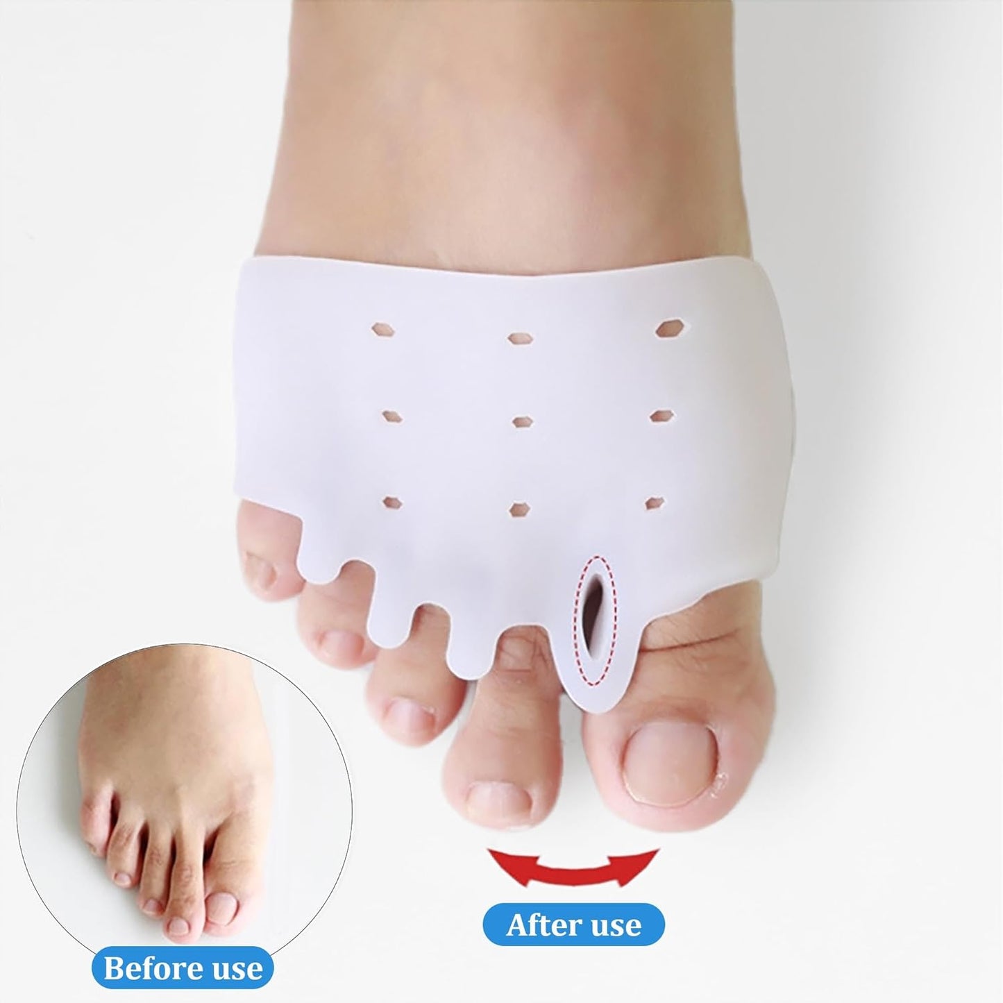 Silicone Toe Separators for Women | Breathable Gel Spacers for Overlapping Toes - Transparent, 4 Pairs