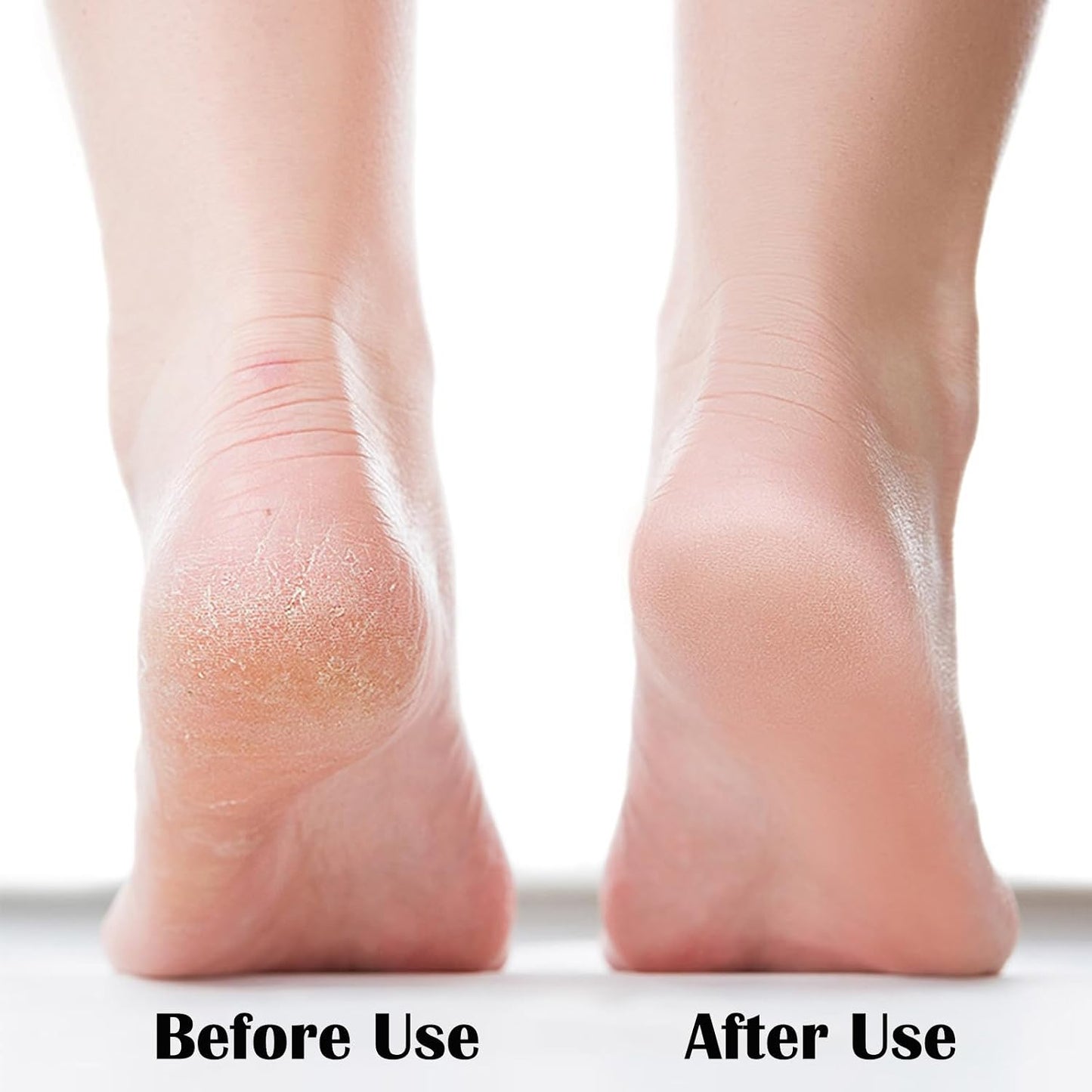 Nano Foot File - Callus Remover & Scrubber Tool for Dead Skin | Portable Pedicure Solution for Wet & Dry Feet